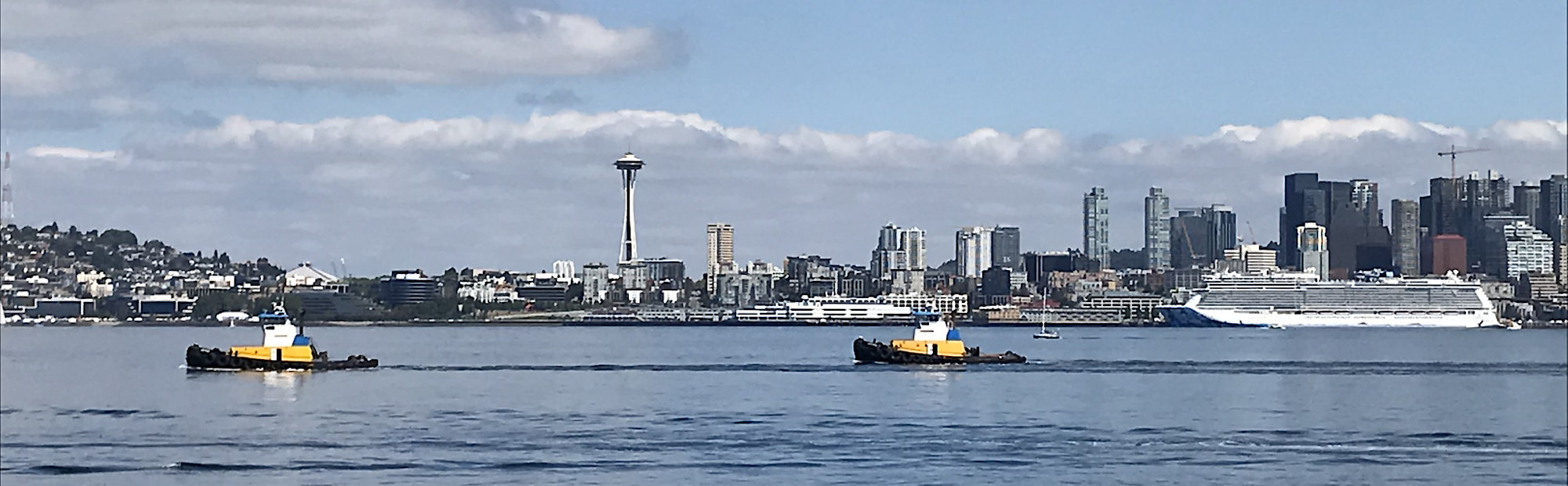 seattle lymphedema therapy